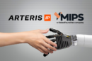 Arteris and MIPS